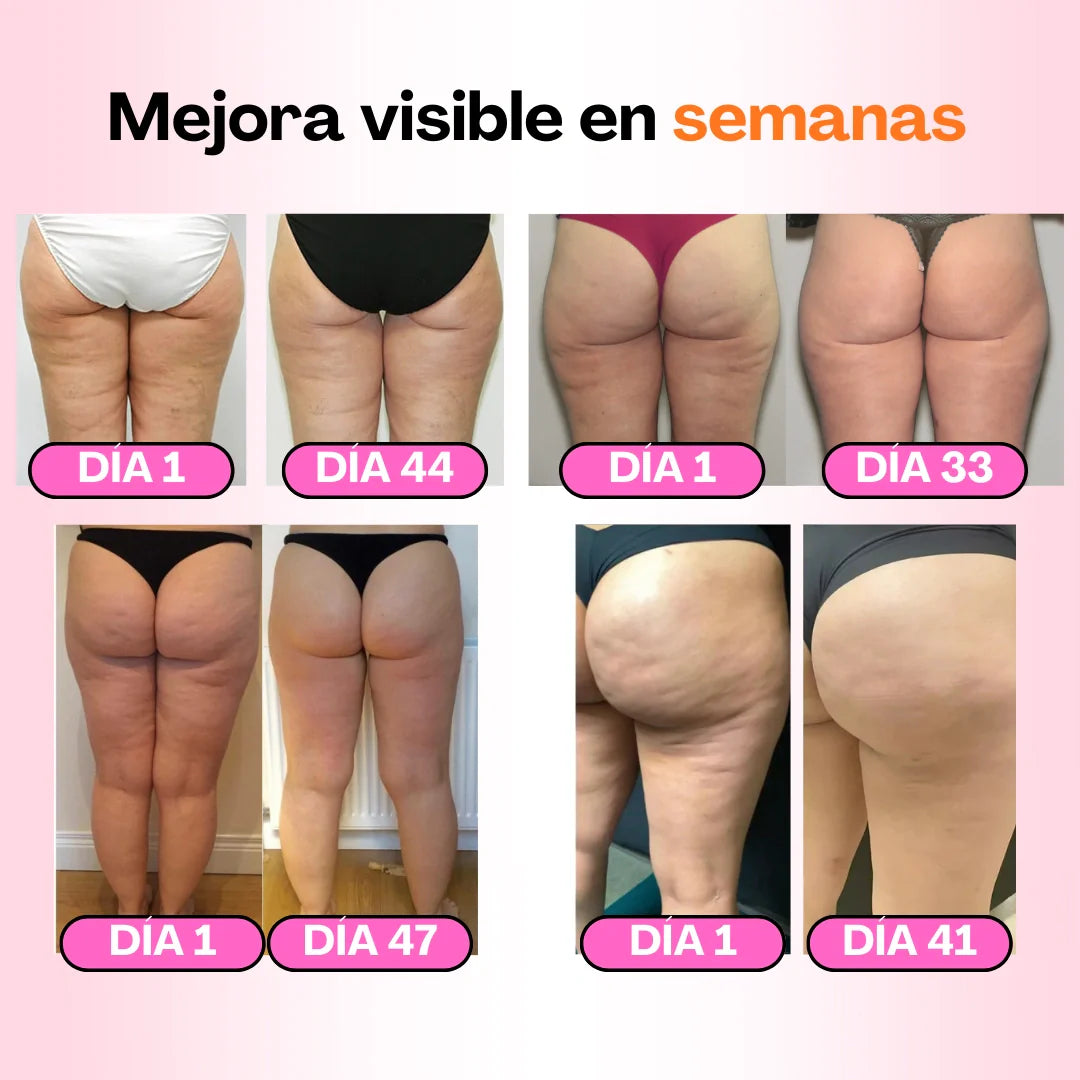 MALLAS ANTICELULÍTICAS SLIMORA PACK DE 3