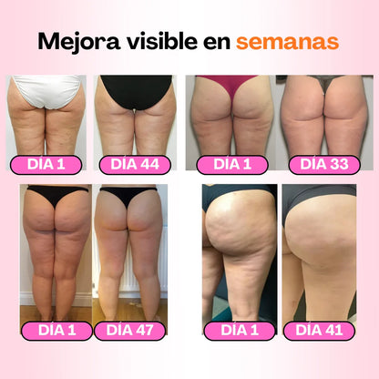 MALLAS ANTICELULÍTICAS SLIMORA PACK DE 3