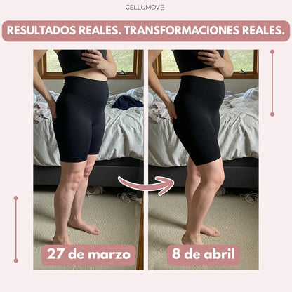 LEGGING SLIMORA  EDEMA POSPARTO