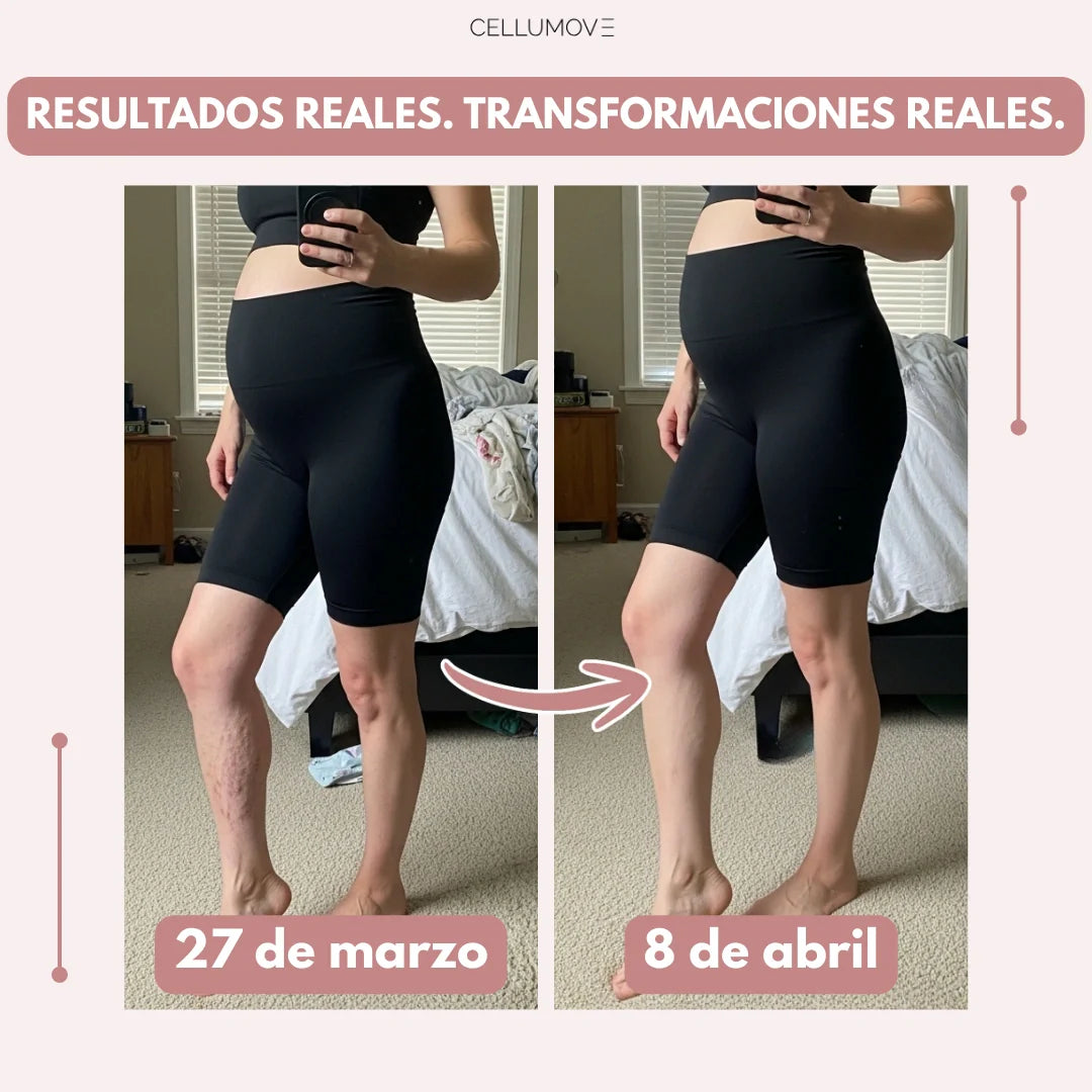 LEGGING SLIMORA  EDEMA POSPARTO